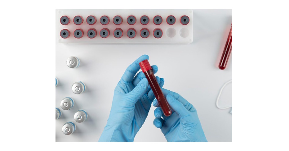 Karaciğer Ve Kolesterol / Trigliserit&nbsp;İlişkisi